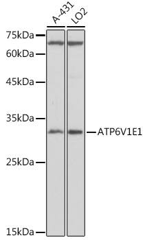 ATP6V1E1 Antibody