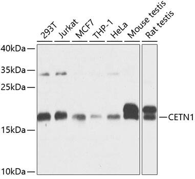 Centrin 1 Antibody