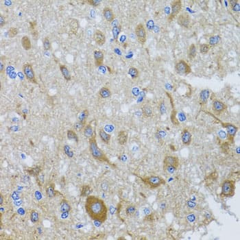 DNCIC1 Antibody