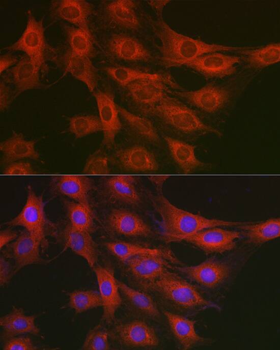 GART Antibody