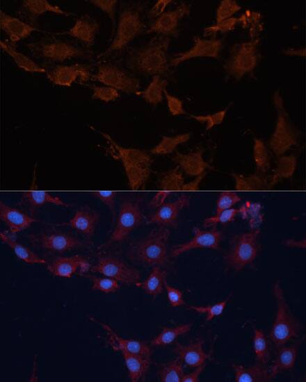 HMGCS1 Antibody