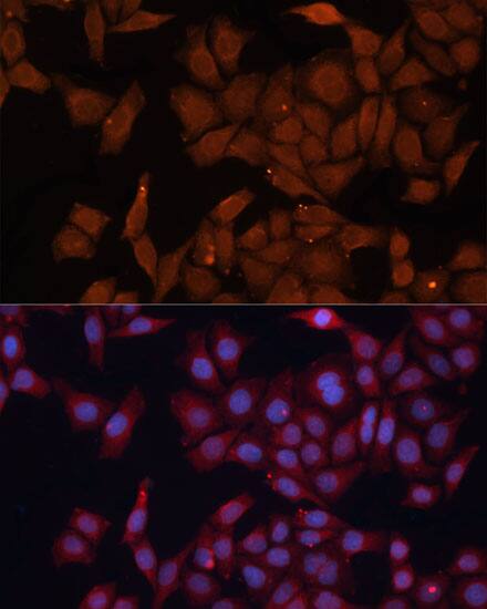 HMGCS1 Antibody