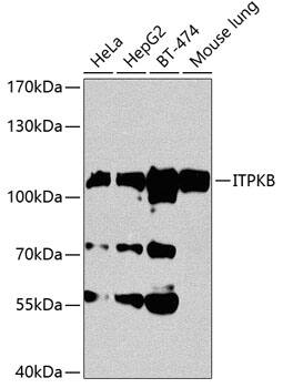 ITPKB Antibody