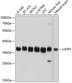 LASP1 Antibody