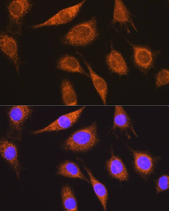 Methylmalonyl Coenzyme A mutase Antibody