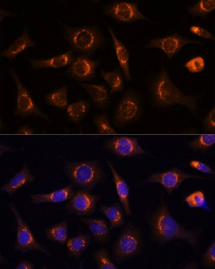 Nucleobindin 1 Antibody