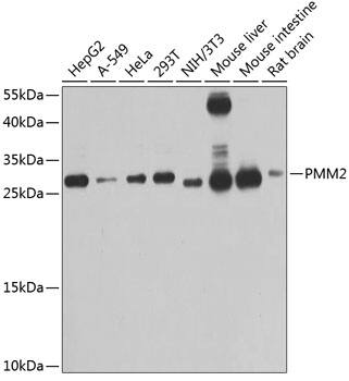 PMM2/Phosphomannomutase 2 Antibody
