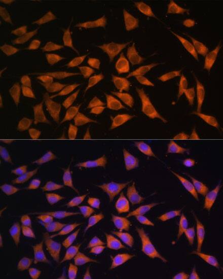 PMM2/Phosphomannomutase 2 Antibody