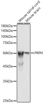 Peripherin Antibody