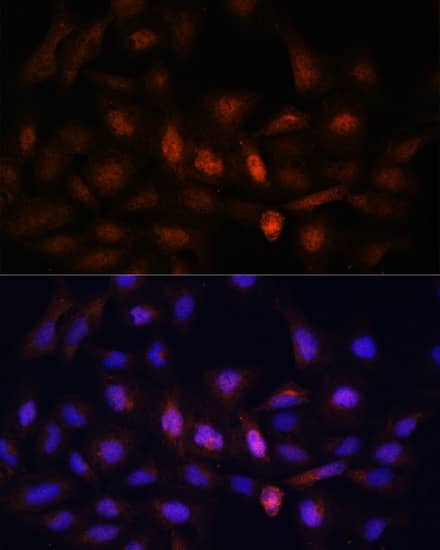 PSMA7 Antibody