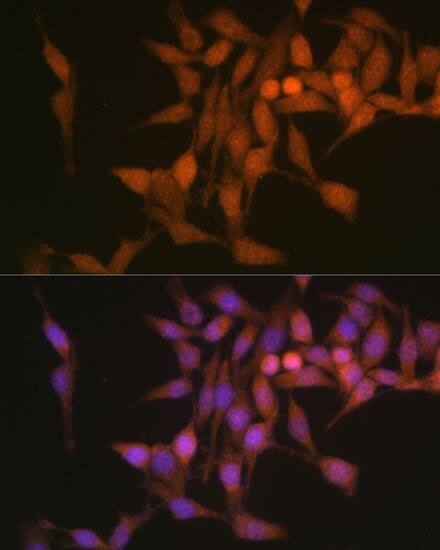 Proteasome 20S beta 6 Antibody