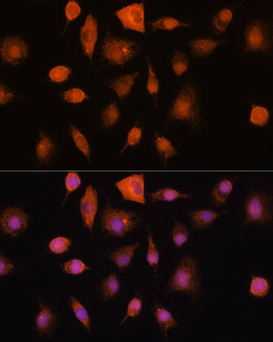 Ribonuclease Inhibitor Antibody