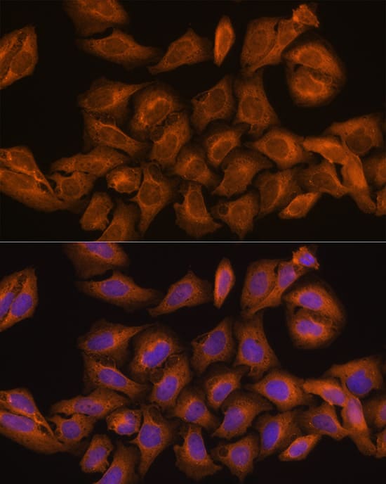 Ribonuclease Inhibitor Antibody