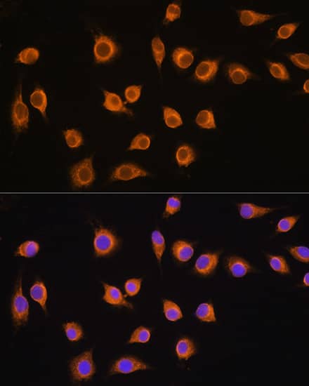 SLC20A1 Antibody