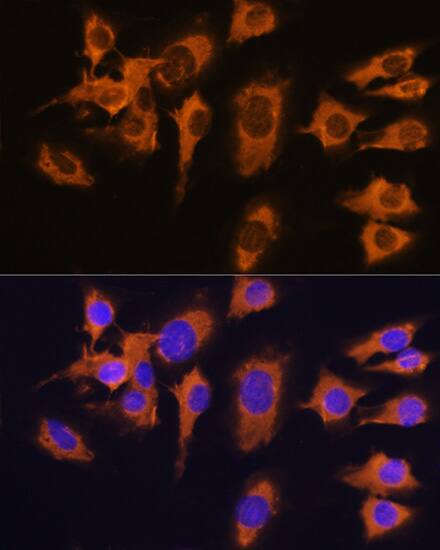 SLC20A1 Antibody