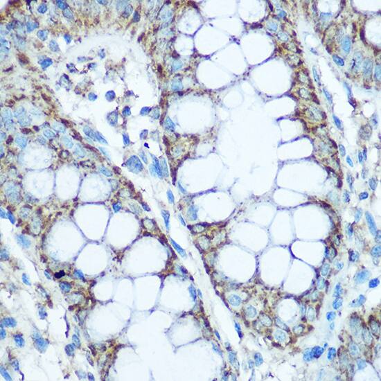 UQCRC2 Antibody