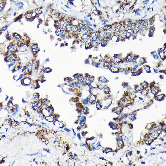 Isopeptidase T/USP5 Antibody