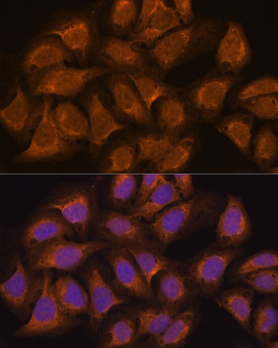 Isopeptidase T/USP5 Antibody