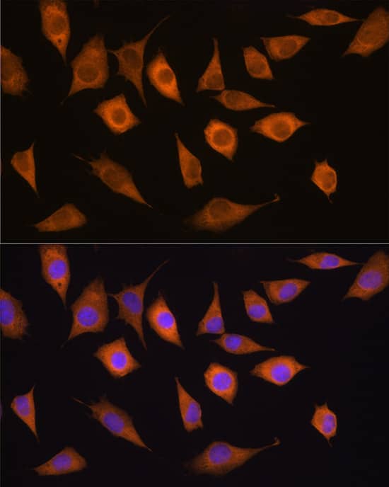 Isopeptidase T/USP5 Antibody
