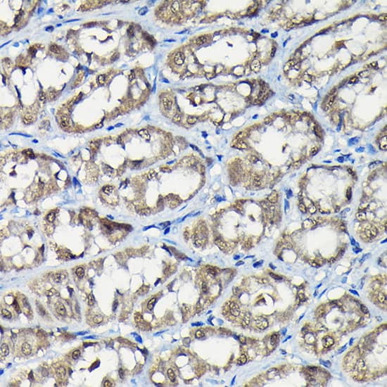 Isopeptidase T/USP5 Antibody
