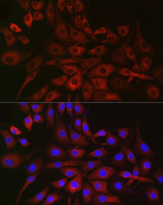 P4HA2 Antibody