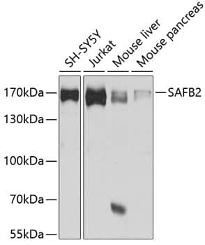 Scaffold attachment factor B2 Antibody