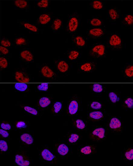 BCAS2 Antibody