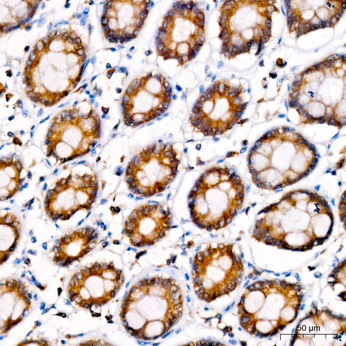 LYPLA1 Antibody