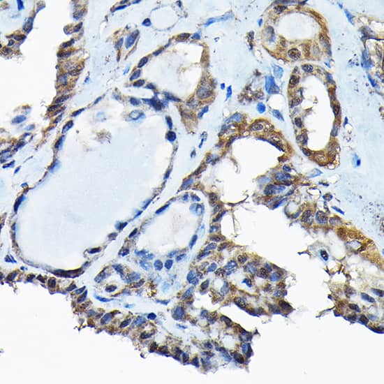 RBBP9 Antibody