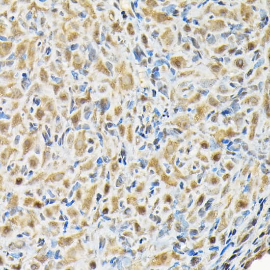 RBBP9 Antibody
