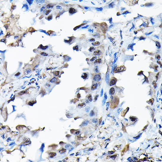RBBP9 Antibody
