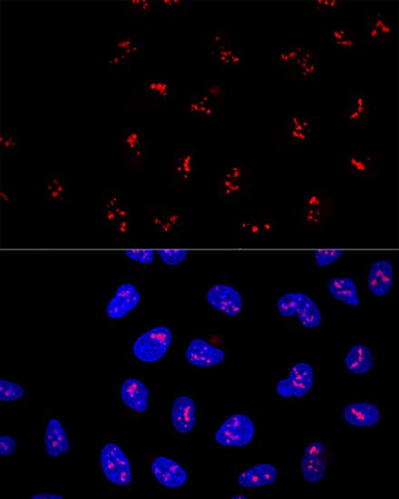 KRR1 Antibody