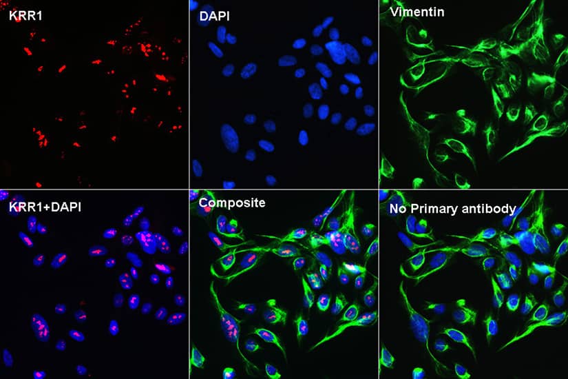 KRR1 Antibody