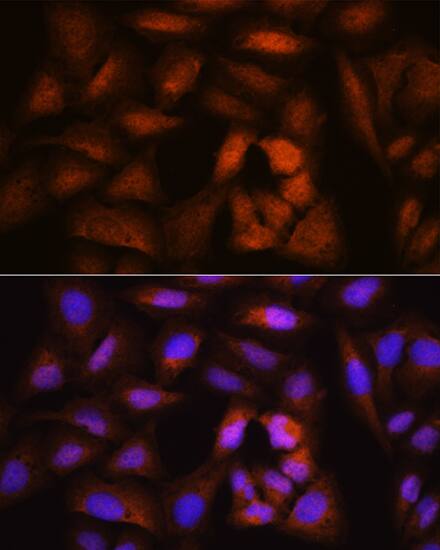 NCAPH Antibody