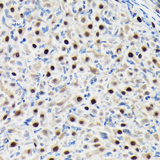 GTPBP4 Antibody