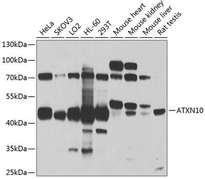 Ataxin-10 Antibody