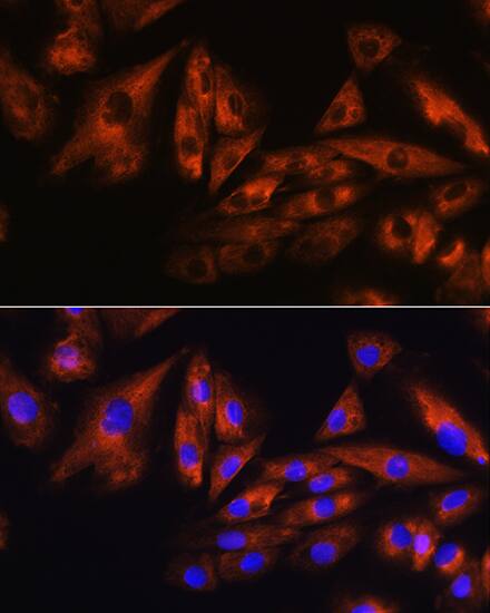 Ataxin-10 Antibody