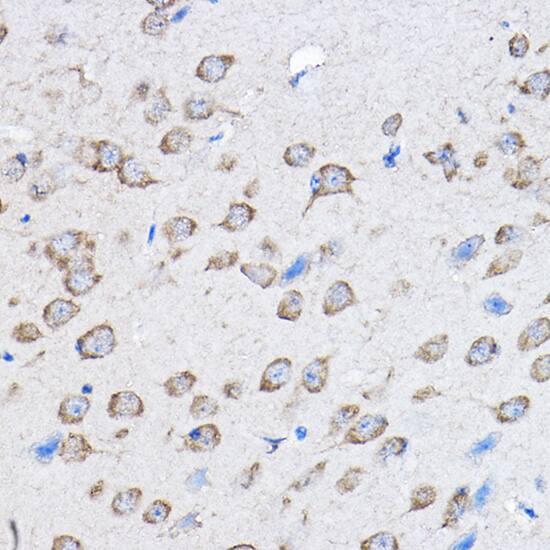 PTPN23 Antibody