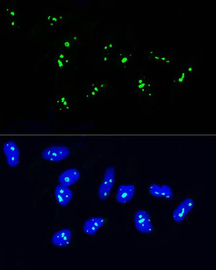 NOP58 Antibody