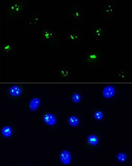 NOP58 Antibody