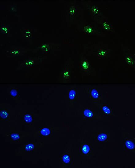 NOP58 Antibody