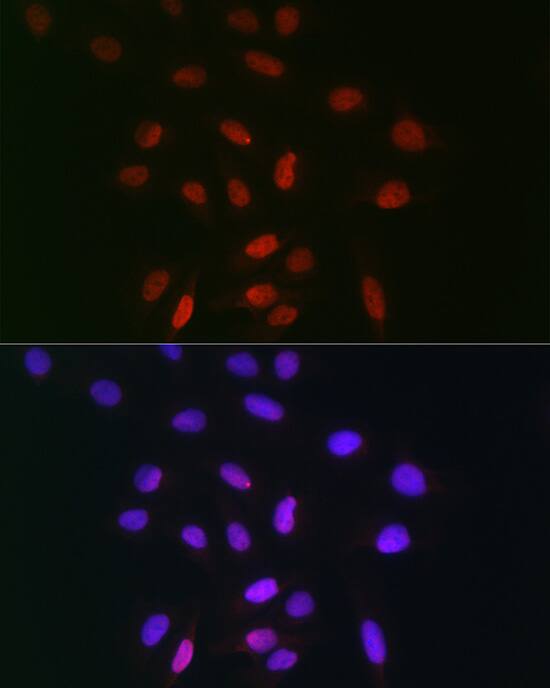 TDP1 Antibody