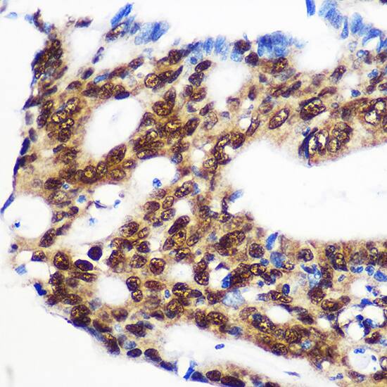 RBM15 Antibody