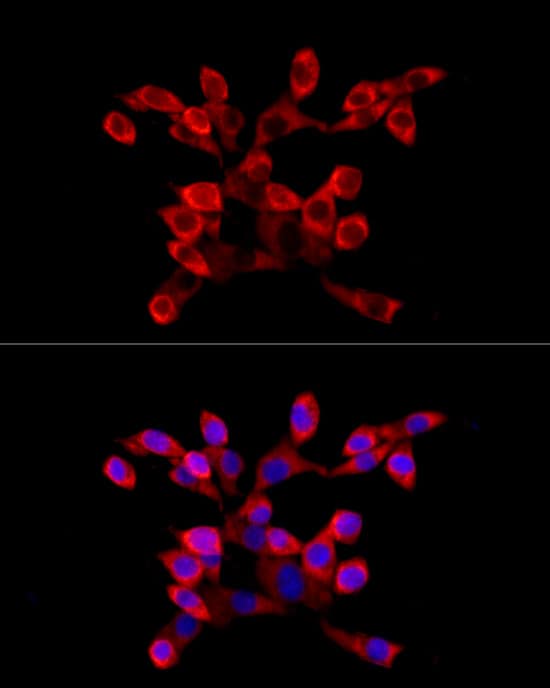 LARP4 Antibody