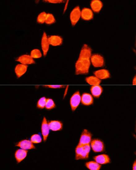 DNAJC19 Antibody