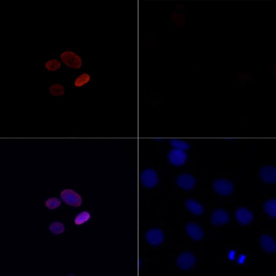 H4 Clustered Histone 1 [ac Lys16] Antibody