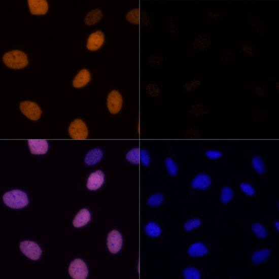 H4 Clustered Histone 1 [ac Lys16] Antibody