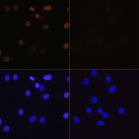 H4 Clustered Histone 1 [ac Lys16] Antibody