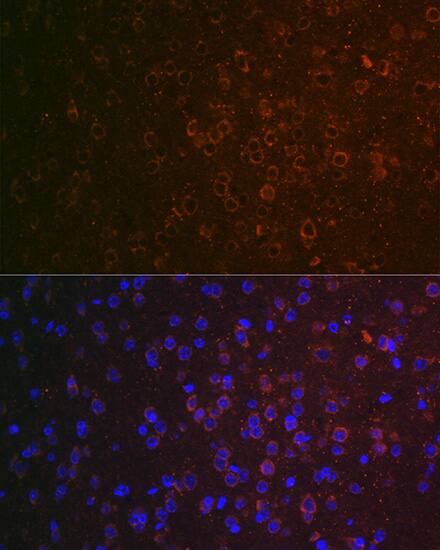 ABAT Antibody