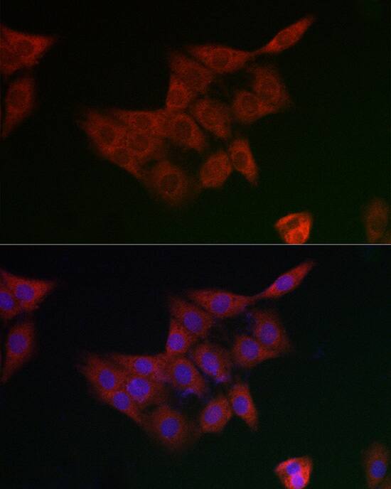 GCLM Antibody